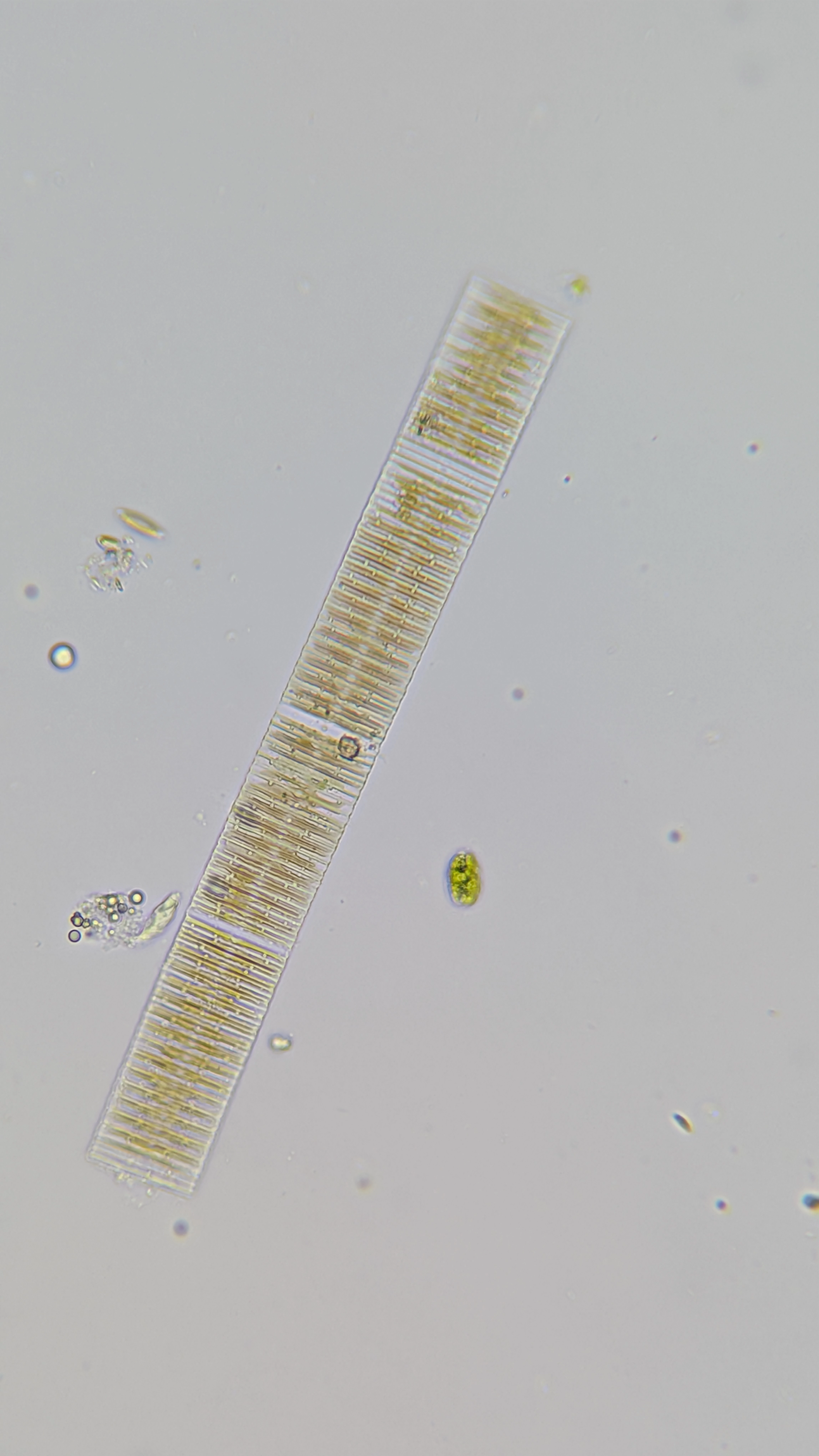 Fragilaria diatom viewed through a microscope