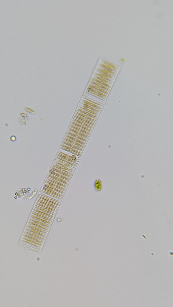 Algae Sample